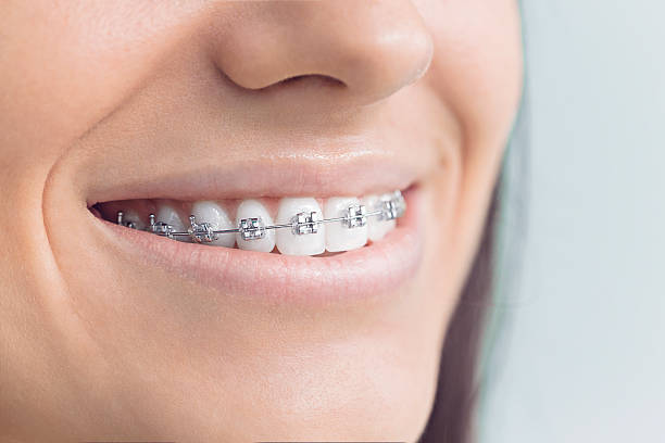 Best Oral Cancer Screening  in Springfield, MA